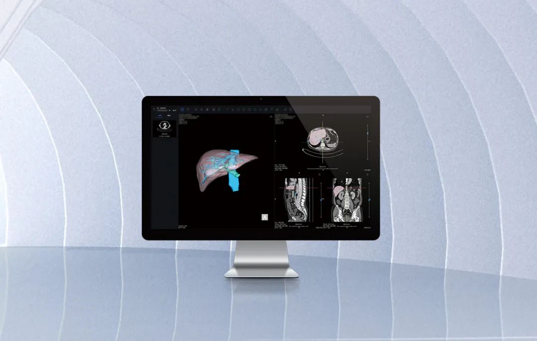 北京市首款！海杰亞醫(yī)療自主研發(fā)的AI+肝臟CT影像處理軟件獲批上市！